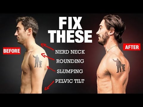 How to Fix Your Posture in 4 Moves PERMANENTLY