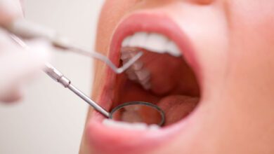 Bad Dental Health Linked to a Greater Risk of Dementia