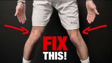 How to Fix Knee Valgus KNEES THAT CAVE IN