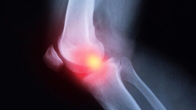 Pain Relievers Like Ibuprofen and Naproxen May Worsen Arthritis Inflammation