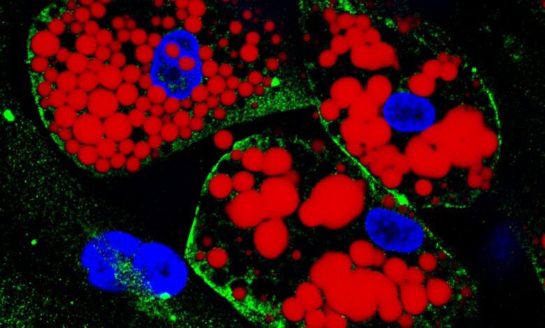 Experiments Show Infection of Visceral Fat Cells May Contribute to