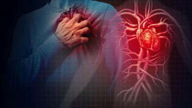 Scientists Are One Step Closer to Understanding Sudden Cardiac Death